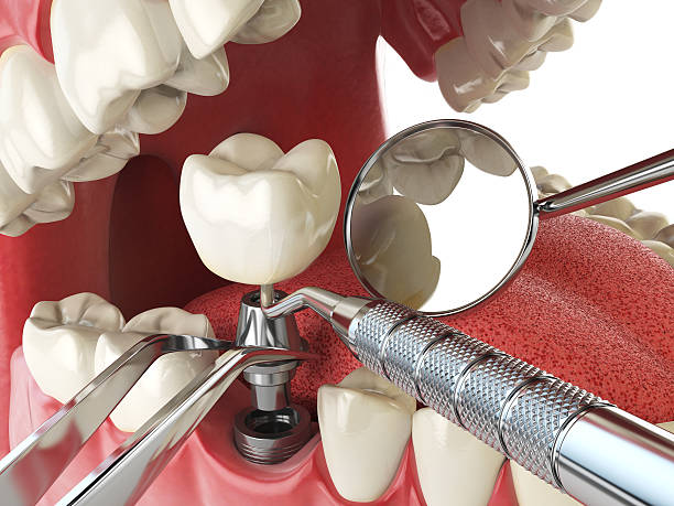 Best Pediatric Emergency Dentist in Laurium, MI